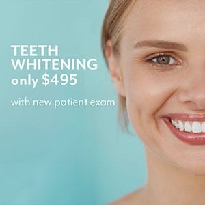 Teeting whitening specials