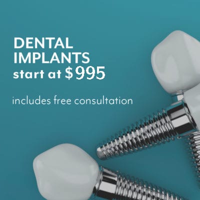 Dental Implant Specials