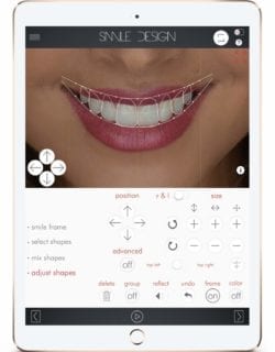 digital smile design dentist in calgary