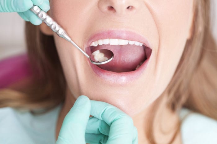 Treat Gum Disease in Calgary, Alberta