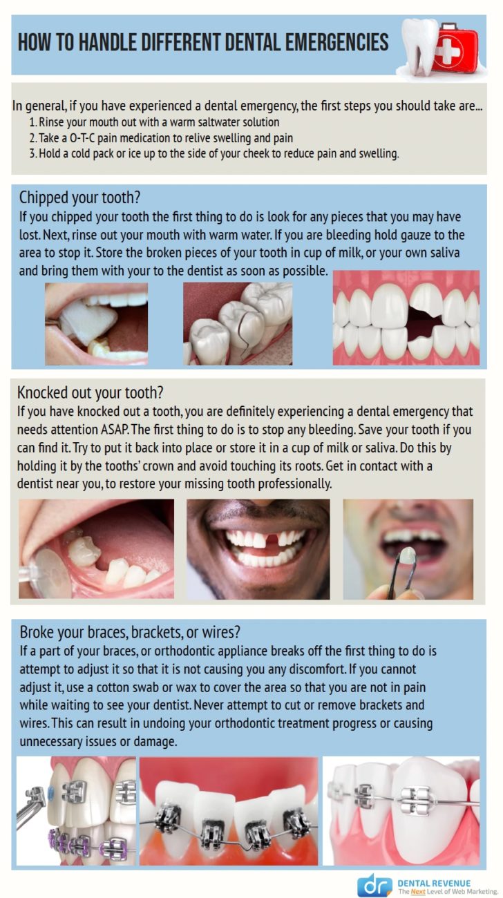 How to Handle Different Dental Emergencies Infographic