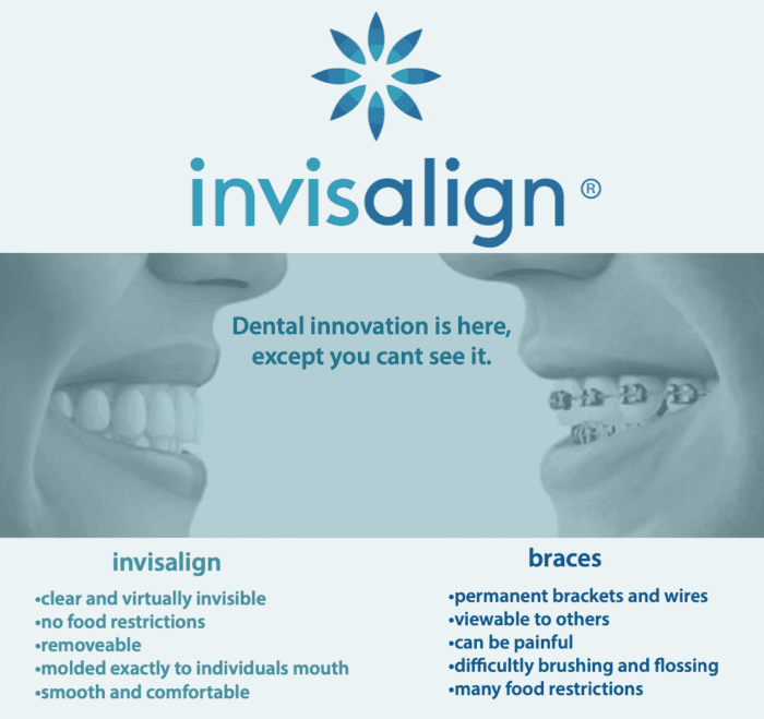 Invisalign infographic