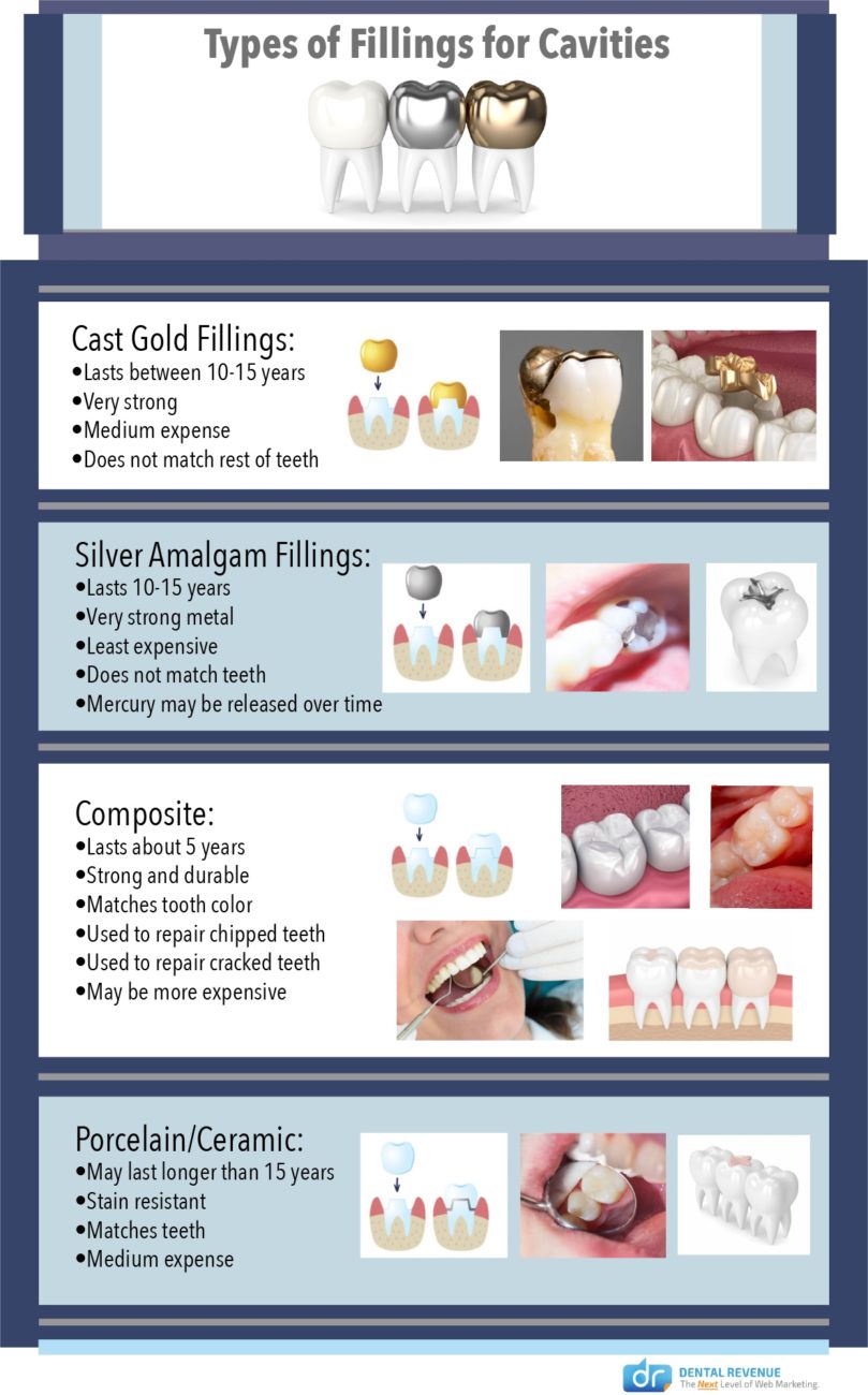 Types fo Fillings For Cavities Infographic