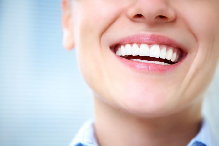 Teeth Whitening in Calgary, Alberta