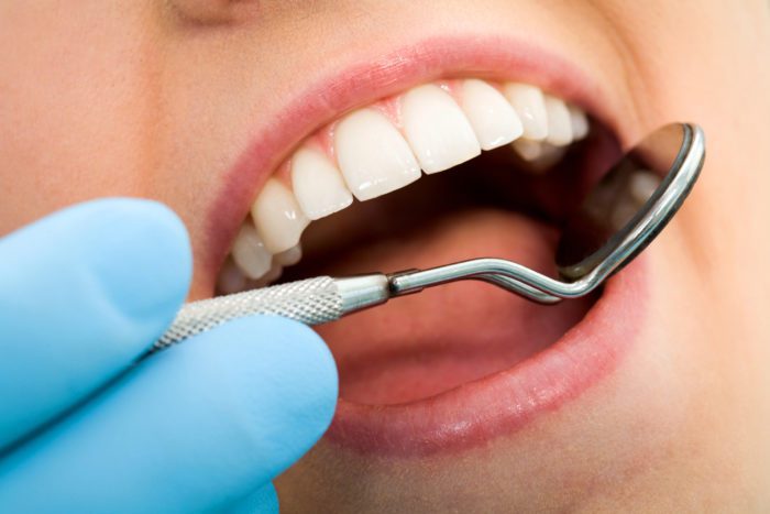 Treat Cavity in Calgary, Alberta