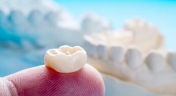 When Do You Need Dental Crowns?