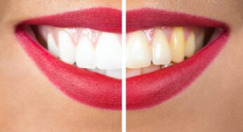 Financing Options for Cosmetic Dentistry